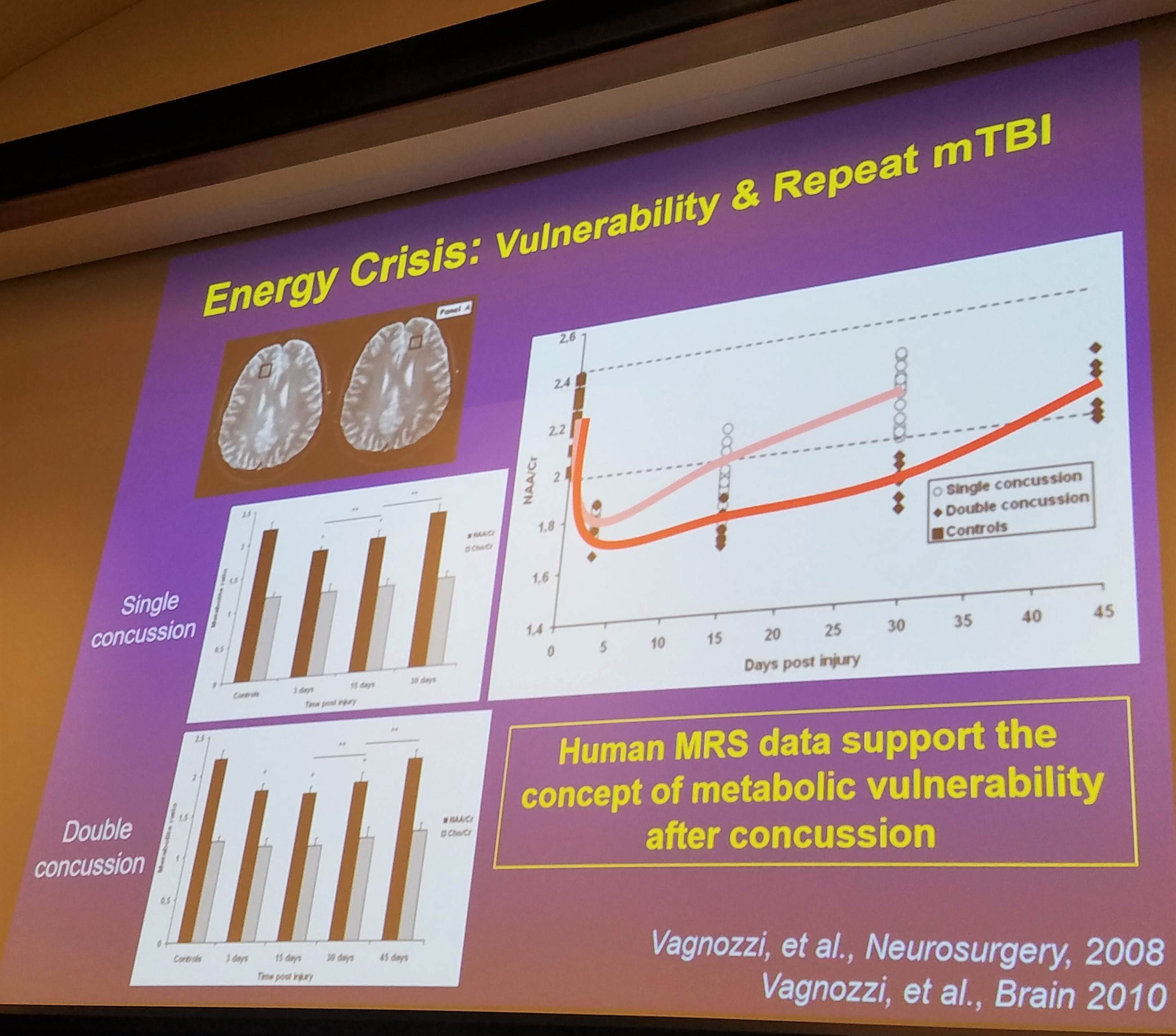 concussion, mechanics of injury, what is a brain injury, how does a head injury occur, concussion and brain trauma, traumatic brain injury, concussion education, concussion facts