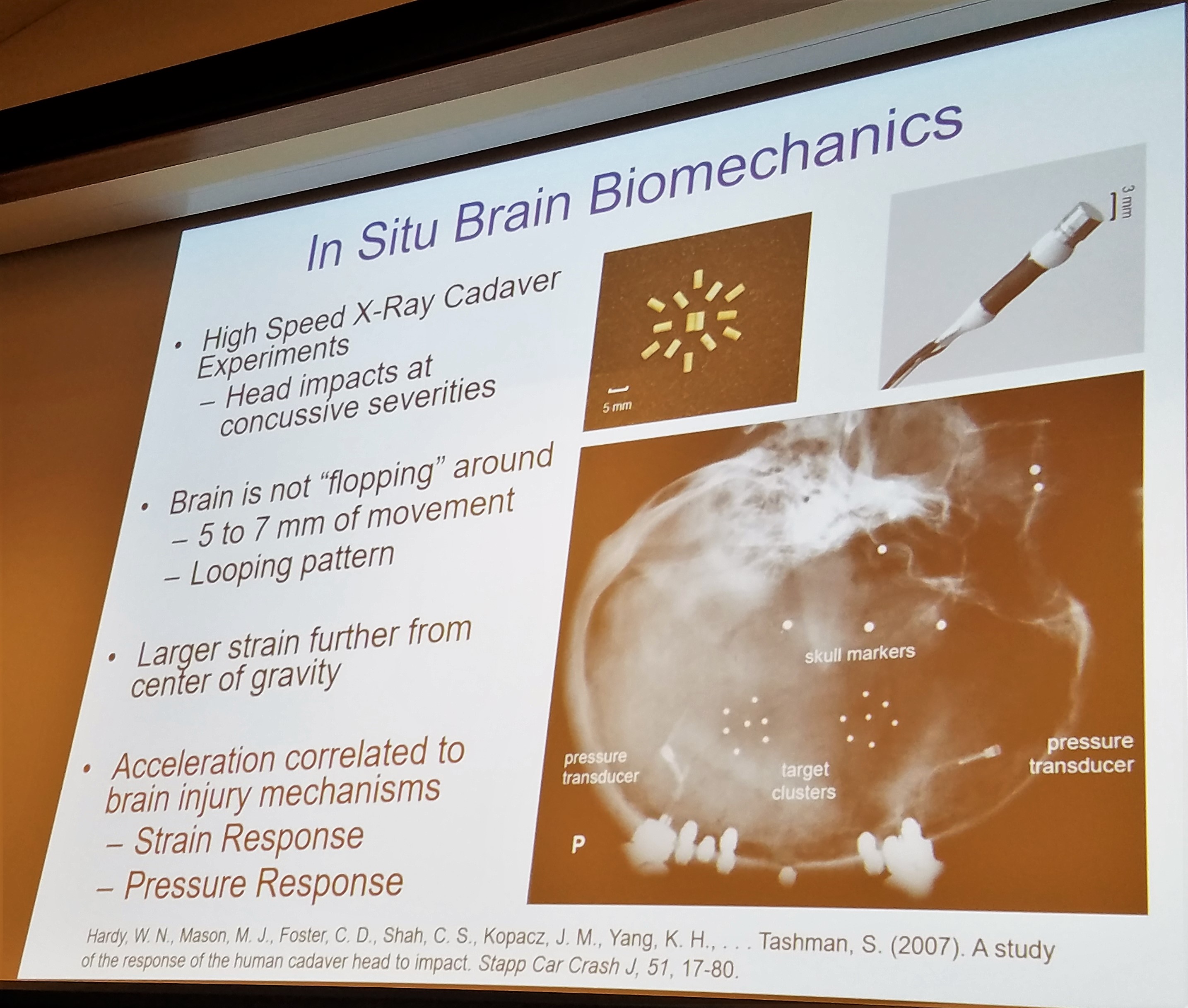 concussion, mechanics of injury, what is a brain injury, how does a head injury occur, concussion and brain trauma, traumatic brain injury, concussion education, concussion facts